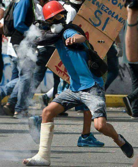 Neomar Lander Neo 17 años baleado a quemarropa por fuerzas seguridad bolivarianas.jpg