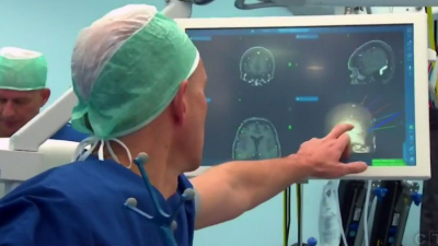 Científicos piden debatir el impacto de los implantes que pueden "leer" el cerebro