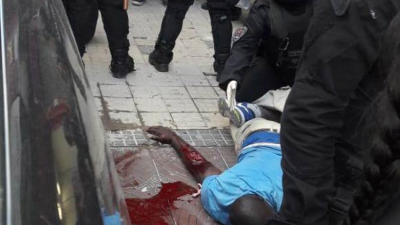Policías hirieron gravemente a un inmigrante senegalés