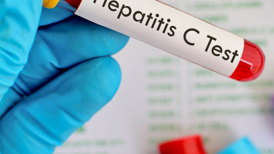 Jóvenes presentaron propuestas para contribuir a eliminar la hepatitis C