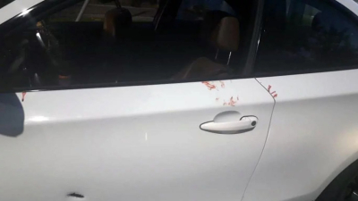 Atacan a balazos a hijo de sindicalista chaqueño en un presunto ajuste de cuentas
