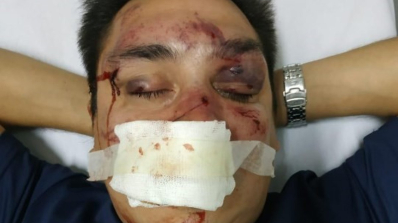 Feroz ataque a un periodista que cubre Racing