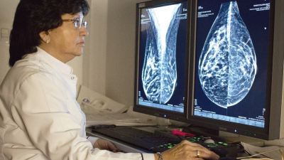 Consultas médicas para prevenir el cáncer de mama