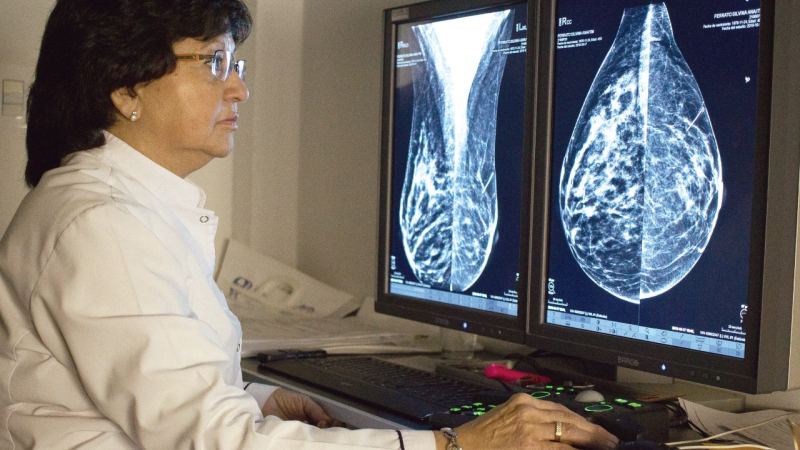 Consultas médicas para prevenir el cáncer de mama