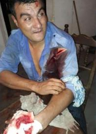 policia herido.jpg copy