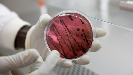 ebola02.jfif