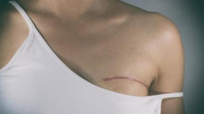 Una bioingeniera desarrolló un algoritmo para detectar el cáncer de mama