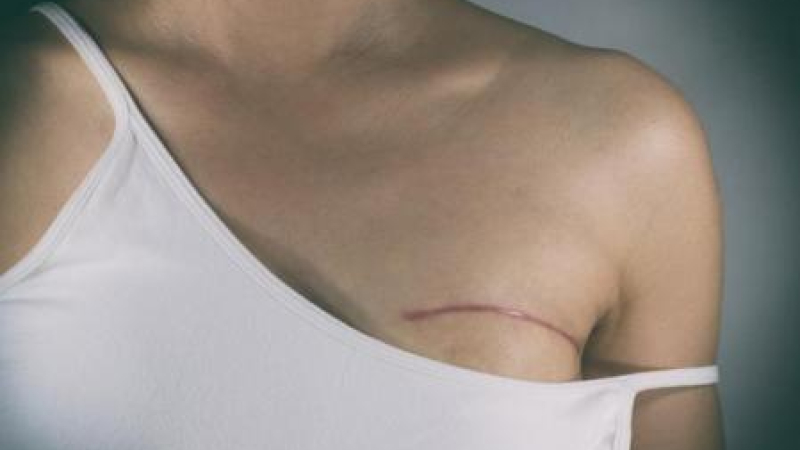 Una bioingeniera desarrolló un algoritmo para detectar el cáncer de mama