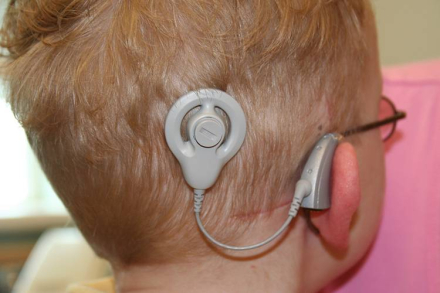 Los-implantes-cocleares-en-edad-temprana-mejoran-la-comprension-lectora-de-los-ninos.jpg