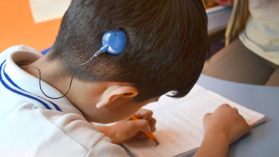Cuatro niños recibieron implantes cocleares en el hospital Avelino Castelán