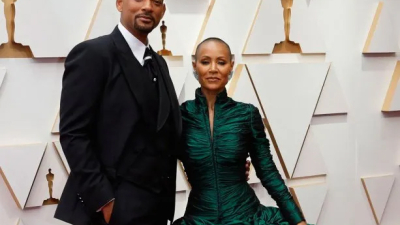 Qué es la alopecia, la enfermedad que padece Jada Pinkett