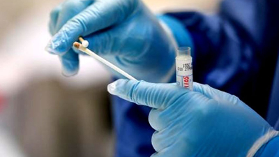 Confirmaron 34 muertes y 1.927 nuevos contagios en las últimas 24 horas