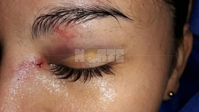 Charata: golpearon brutalmente a una joven para robarle celular y zapatillas