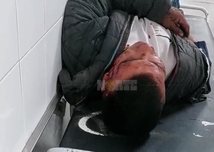 golpeado 13 de diciembre.jpeg
