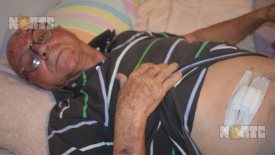 Salvajismo extremo en intento de robo a un vecino en Sáenz Peña
