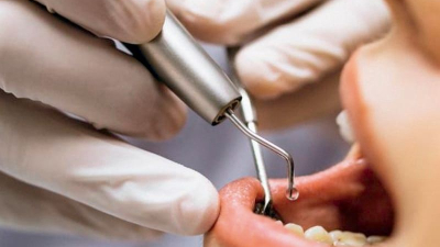Por un dolor de muelas fue al dentista, pero terminó con un implante en el cerebro