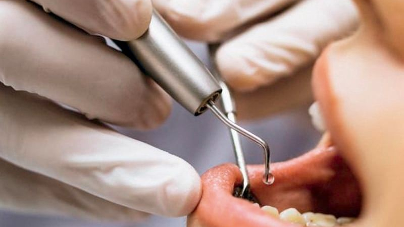 Por un dolor de muelas fue al dentista, pero terminó con un implante en el cerebro