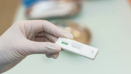 VIH test.jpg