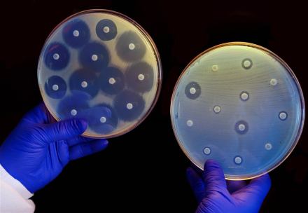 cultivo-de-bacterias-en-dos-placas-de-antibioticos_ba122929_1280x883.jpg