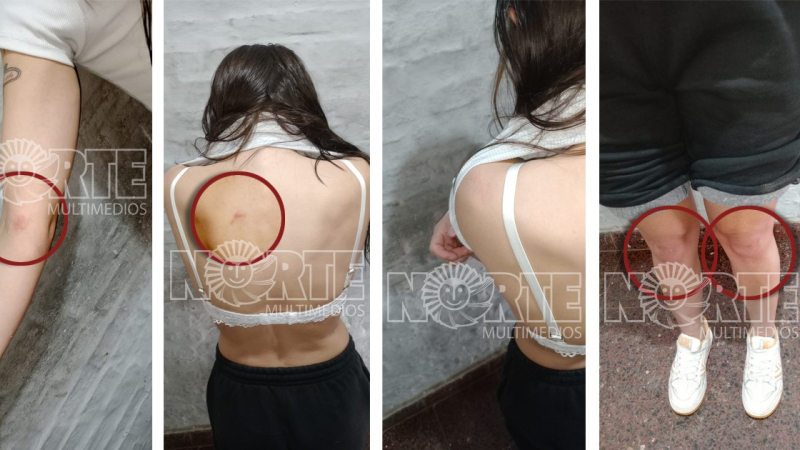 Adelanto de NORTE: Victoria Luz Cantero presentaba lesiones en cuello, brazos y rodillas