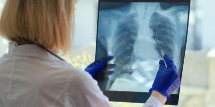 pulmones