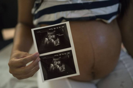 Brazil, Scientists are trying to figure out how Zika virus may be affecting fetuses. Felipe Dana AP.jpg