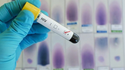 Tests de VIH en la plaza