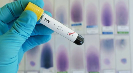 hiv.jpg