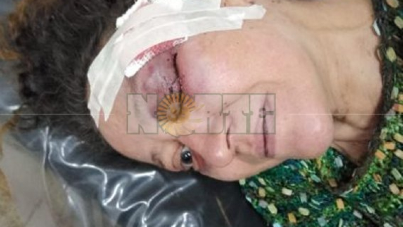 Otra violenta entradera en Resistencia: mujer sufre una brutal golpiza durante el robo en su casa