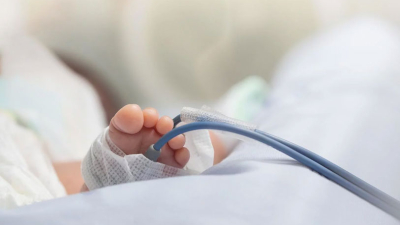Negligencia médica: un bebé nació sin rostro