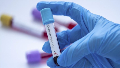 Coronavirus en Argentina: se registraron 15.099 casos y 515 muertes