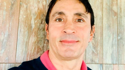 Sebastián Estevanez mostró su cara recuperada a tres meses de haber sufrido graves quemaduras