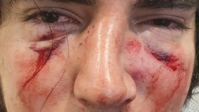 Denuncian a cuatro rugbiers por "lesiones graves" por una brutal golpiza a un joven en Córdoba