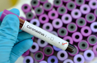 Coronavirus en el Chaco: ayer hubo 137 contagiados
