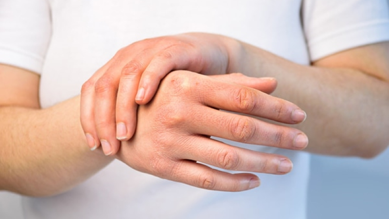 Las uñas pueden revelar si alguien tuvo coronavirus asintomático