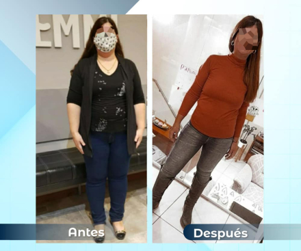 1antesydespues04.jpg