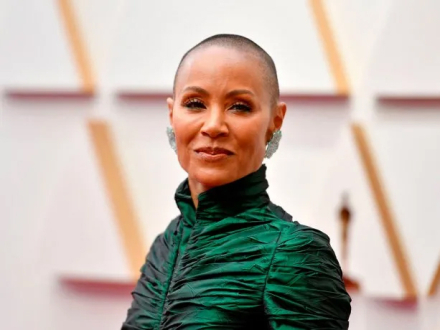 alopecia2.jpg
