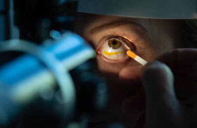 Cerca de 5 de cada 10 personas que tienen glaucoma no lo saben