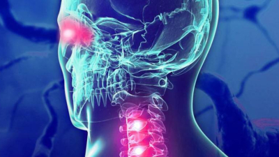 Semana de la neuromielitis óptica: de qué se trata esta enfermedad rara