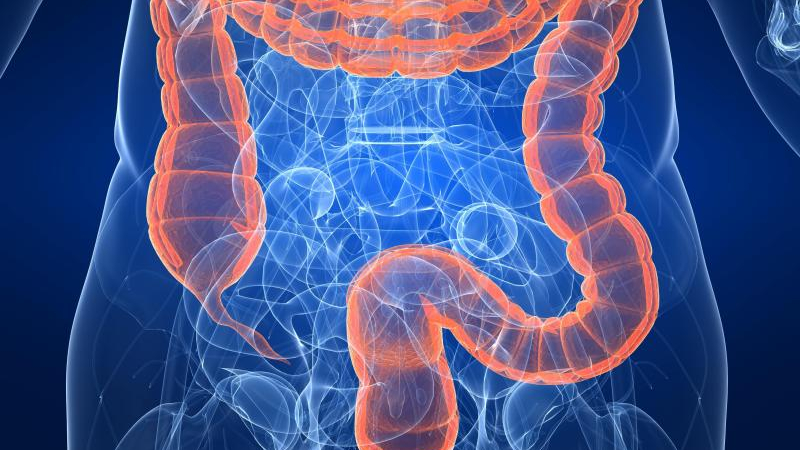 Aumentan los casos de cáncer colorrectal en personas menores de 50 años