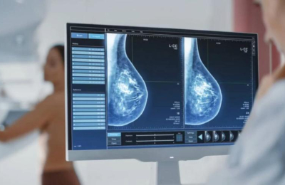 Durante la menopausia se deben mantener los controles de las mamas