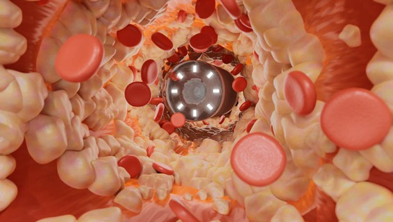 endoscopia capsular.jpg