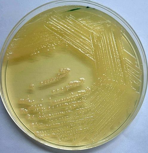 SuperbacteriaUM2.jpg