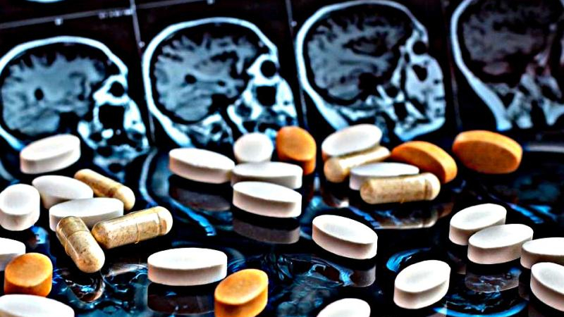 Nuevo fármaco contra el alzhéimer reduce placas amiloides e inflamación cerebral