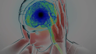 Migraña: la segunda causa de discapacidad en el mundo