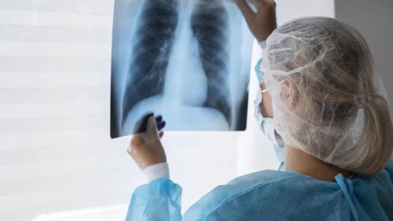 Alerta sanitaria nacional: «Hay un aumento de la tuberculosis en las poblaciones vulnerables"