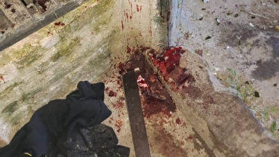 Dos hombres aprehendidos tras una violenta pelea con machete