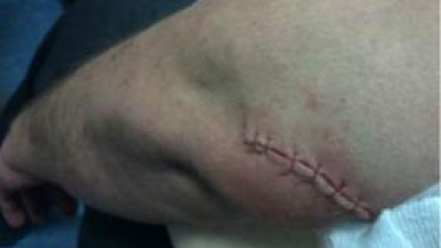 Insaciable: Manito de Miel acuchilló a un policía Federal para robarle el arma