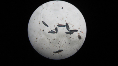 Aseguran que el huevo del Aedes podrá permanecer hasta un año en estado latente, con el embrión en su interior