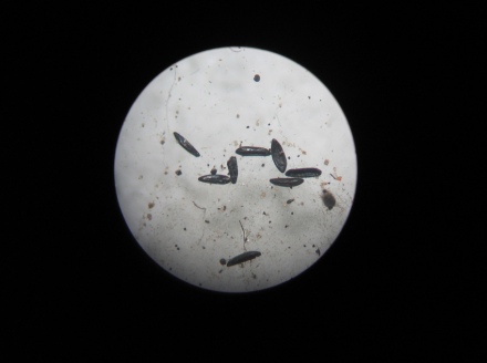 huevos de mosquito.jpg